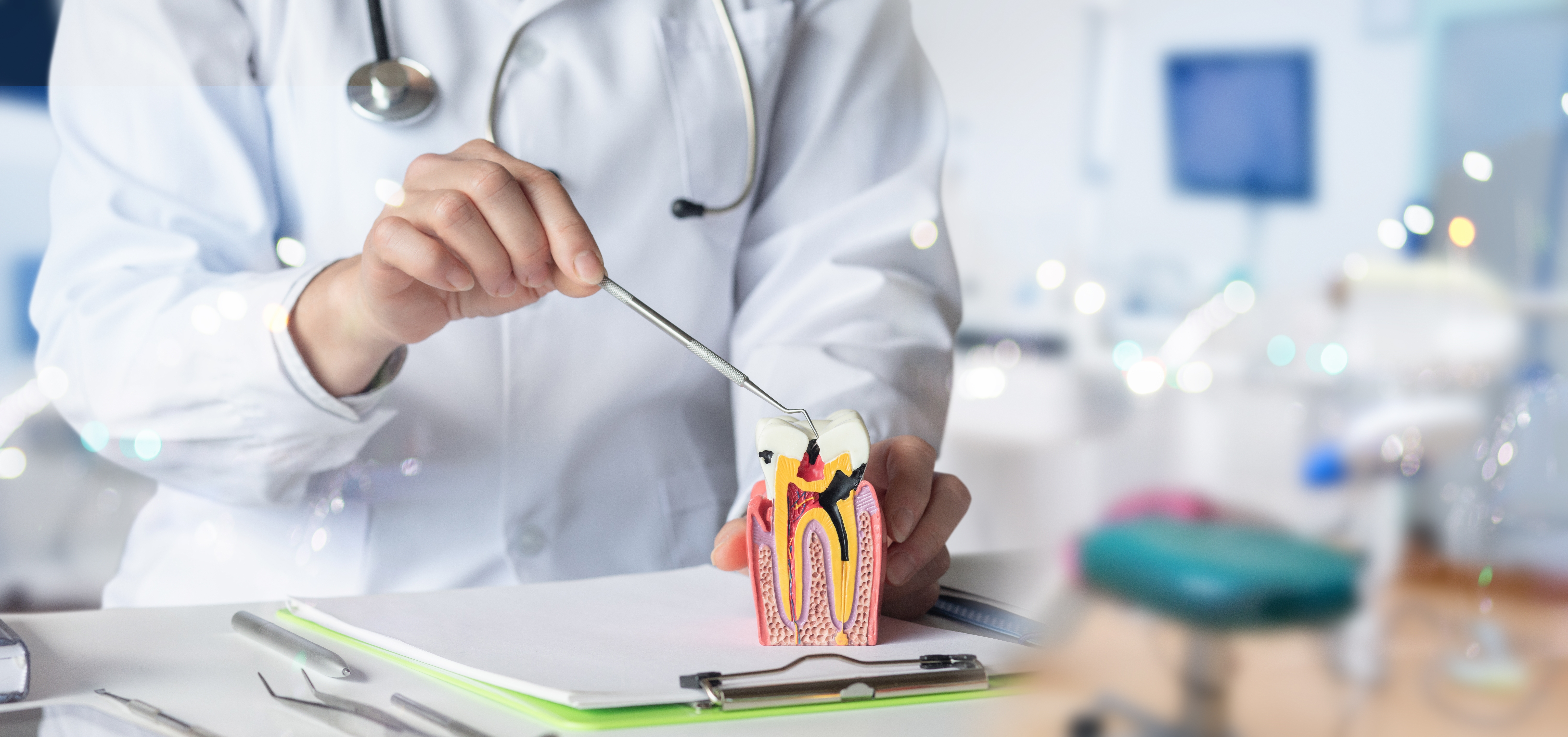 Root Canal Treatment in San Ramon, CA